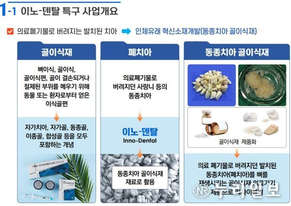 대구광역시, 세계 최초로 동종치아 골이식재 개발에 나선다!